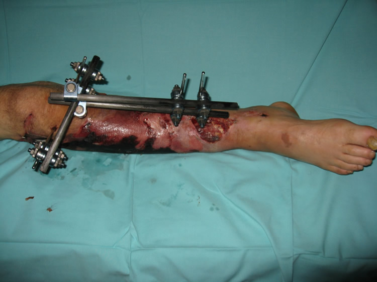 Evolución a los 10 días — viabilidad cutánea