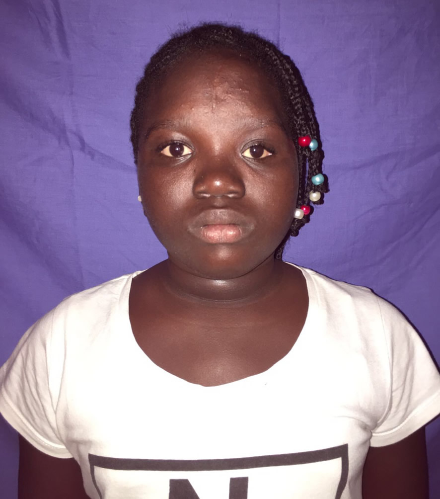 Resultado a los 5 años