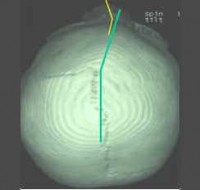 TAC 3D — Asimetría craneal