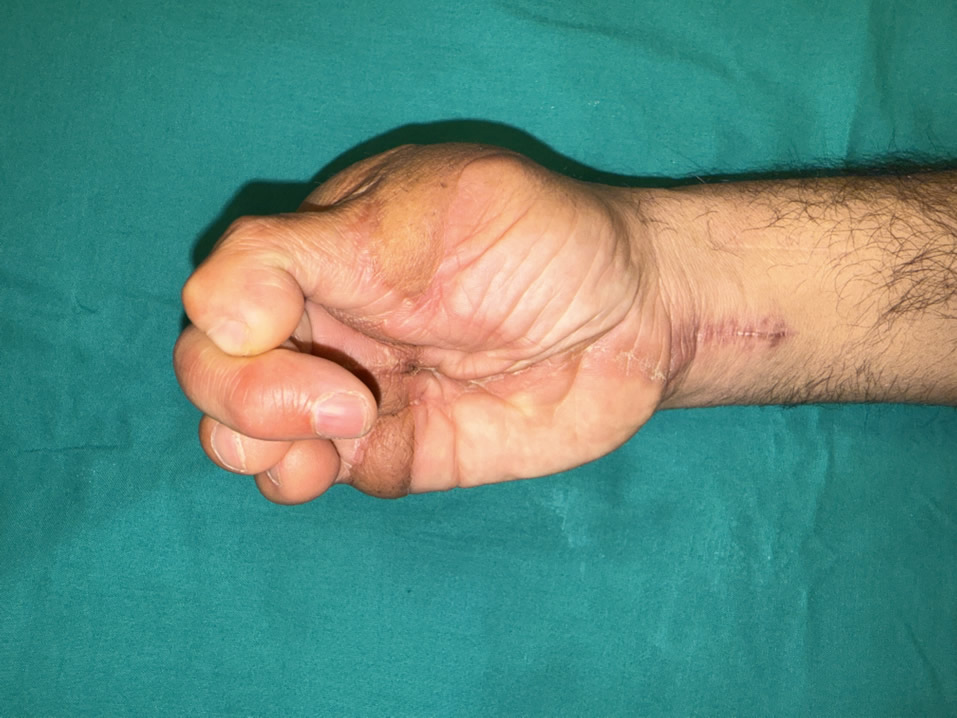 Función postoperatoria